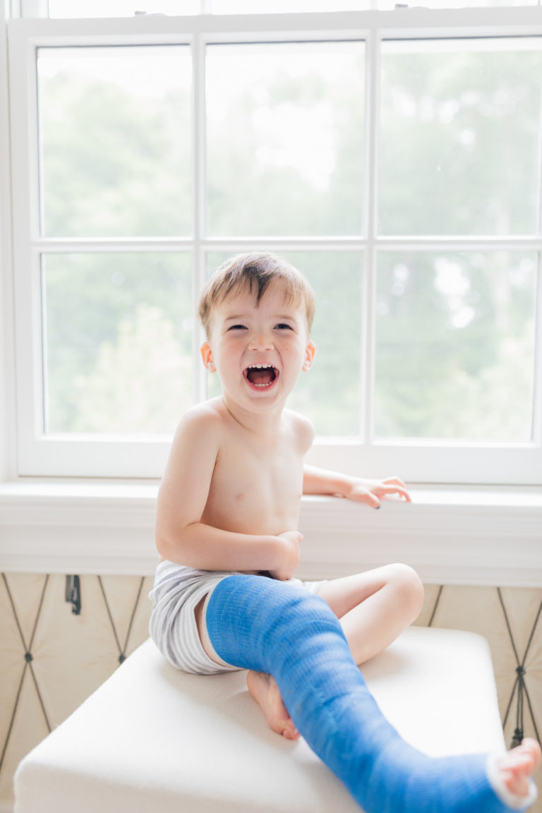 Tips For Surviving A Toddler Broken Leg Happily Eva After