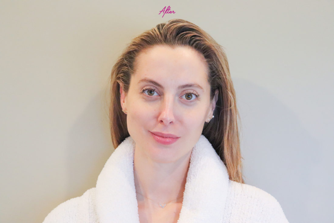 Blogger Eva Amurri after gua sha treatment